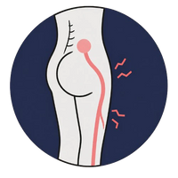 Sciatica & pain down the leg
